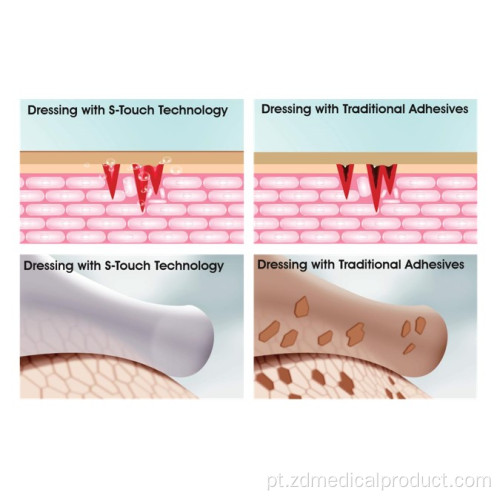 Curativo de espuma de silicone com estrutura multicamadas